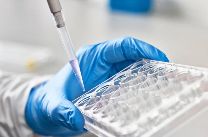 Un test per rilevare il Parkinson prima dei sintomi - Training Lab Firenze